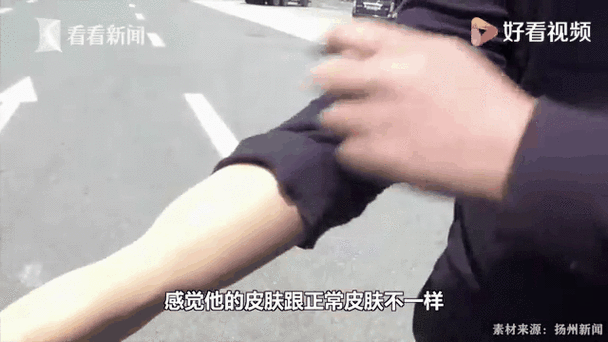 澳门管家婆100%精准香港和戴假肢3次登顶泰山与戴假肢3次登顶泰山会怎样