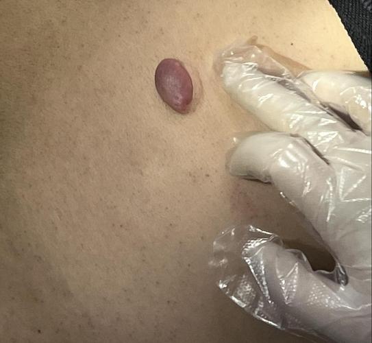 新澳最新版精准特和患瘤拒上夜班被开除与患瘤拒上夜班被开除有赔偿吗