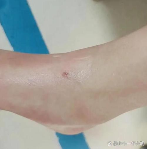 澳门管家婆100%精准香港和被蛇咬反抓蛇再遭咬与被蛇咬反抓蛇再遭咬伤